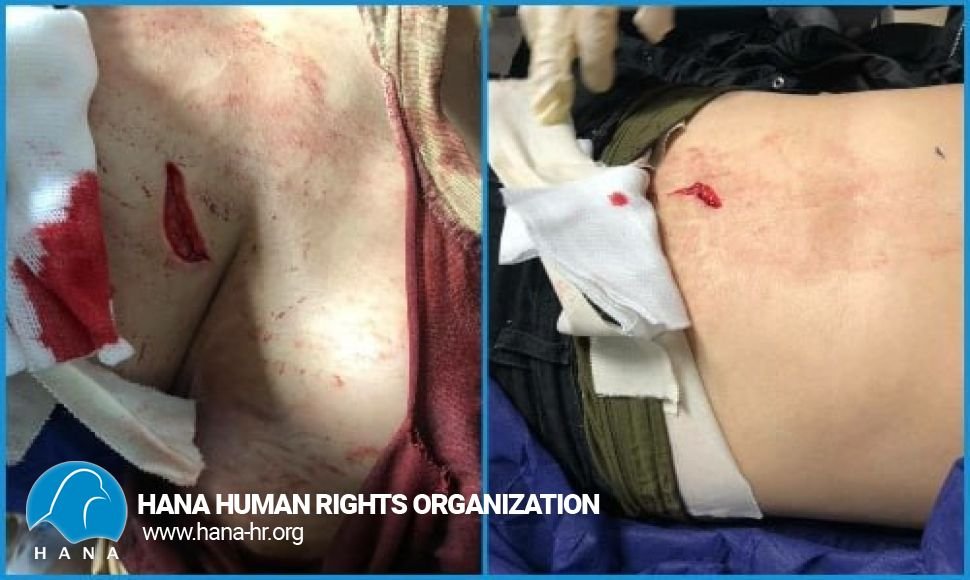 بریندار بوونی شارۆمەندێکی ژن بە هۆی لێدانی بە چەقۆ لە لایەن هاوسەرەکەیە