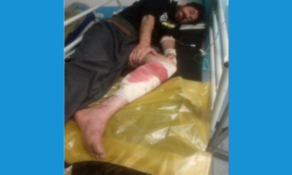 بریندار بوونی دوو کۆڵبەر بە تەقەی هێزەنیزامییەکان لە سنووری بانە