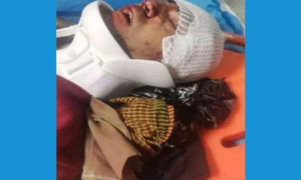 جوانڕۆ ؛ کۆڵبەرێک بە هۆی تەقەی هێزە نیزامیەکان چووە حاڵەتی کۆما